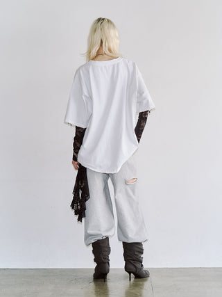 PIGMENT OVER T